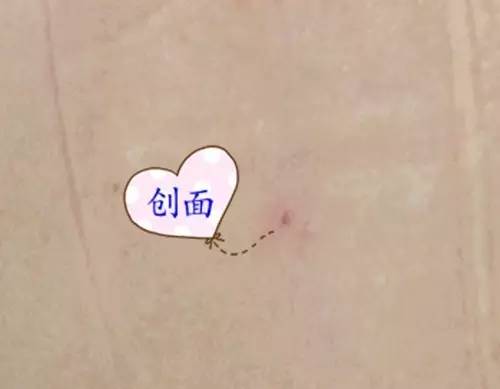 【永醫(yī)前沿】外三科順利完成“CT定位下肝腫瘤射頻消融手術(shù)”！